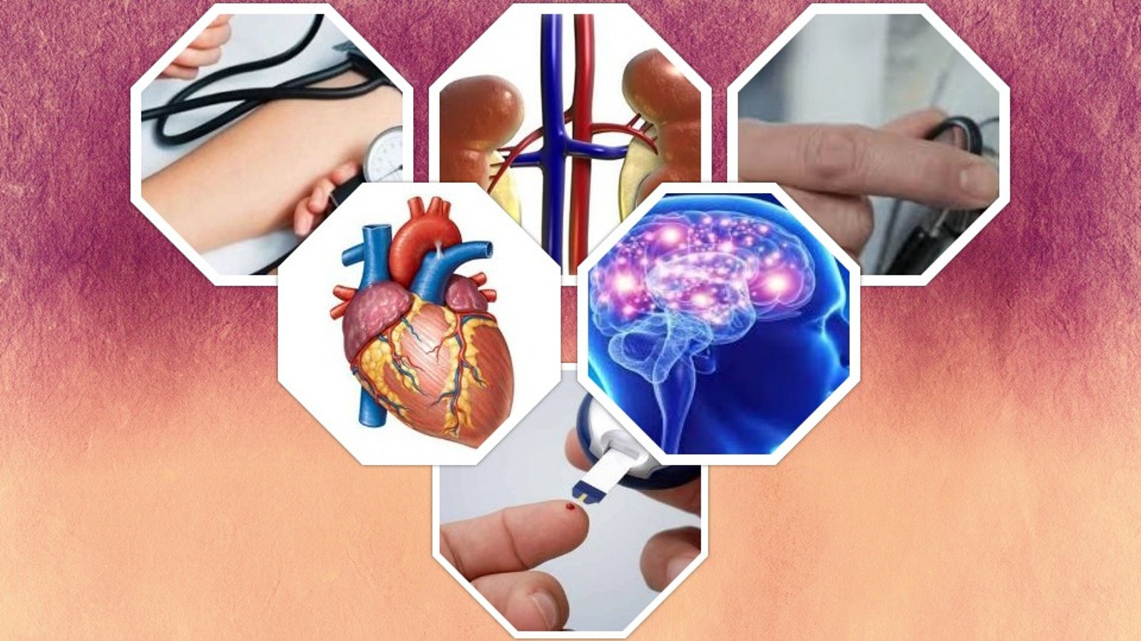नेपालमा नसर्ने रोगबाट ६६ प्रतिशत मानिसको मृत्यु