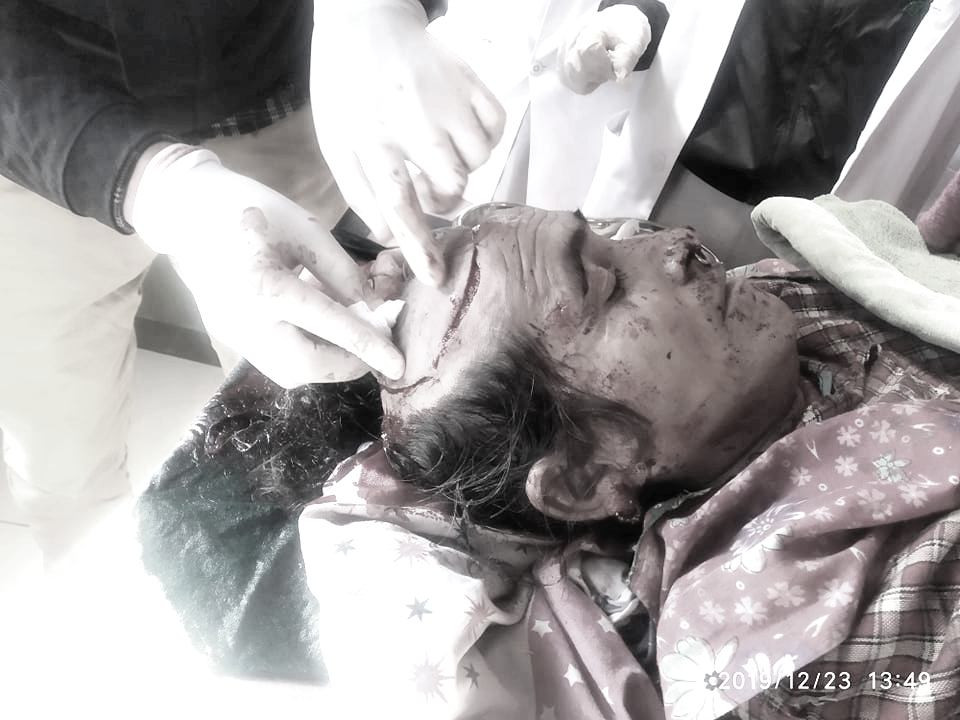 बझाङमा भालु आतंक, आक्रमणबाट एक महिला गम्भीर घाइते
