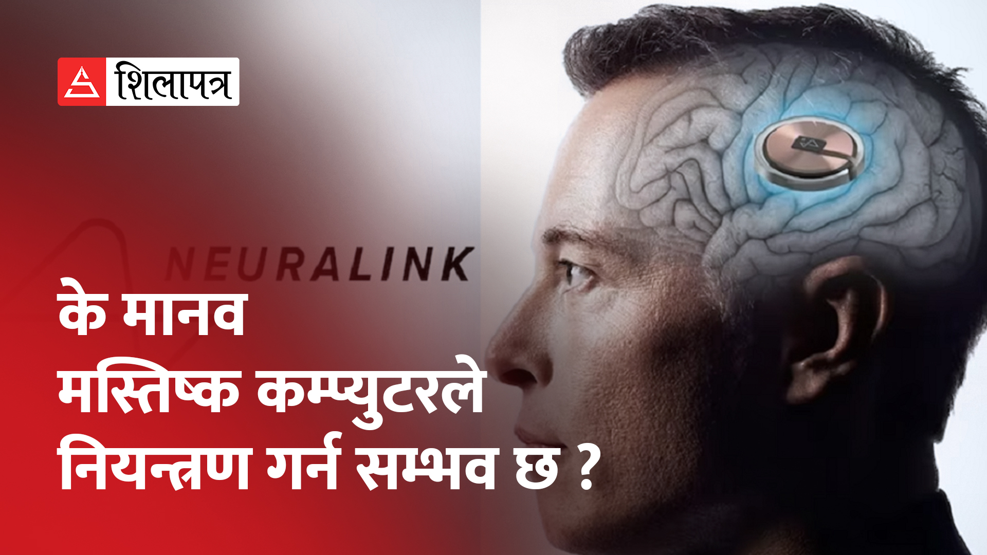 मानव मस्तिष्कमा डिजिटल चिप्स लगाउन न्युरालिंकले पायो अनुमति (भिडियो)