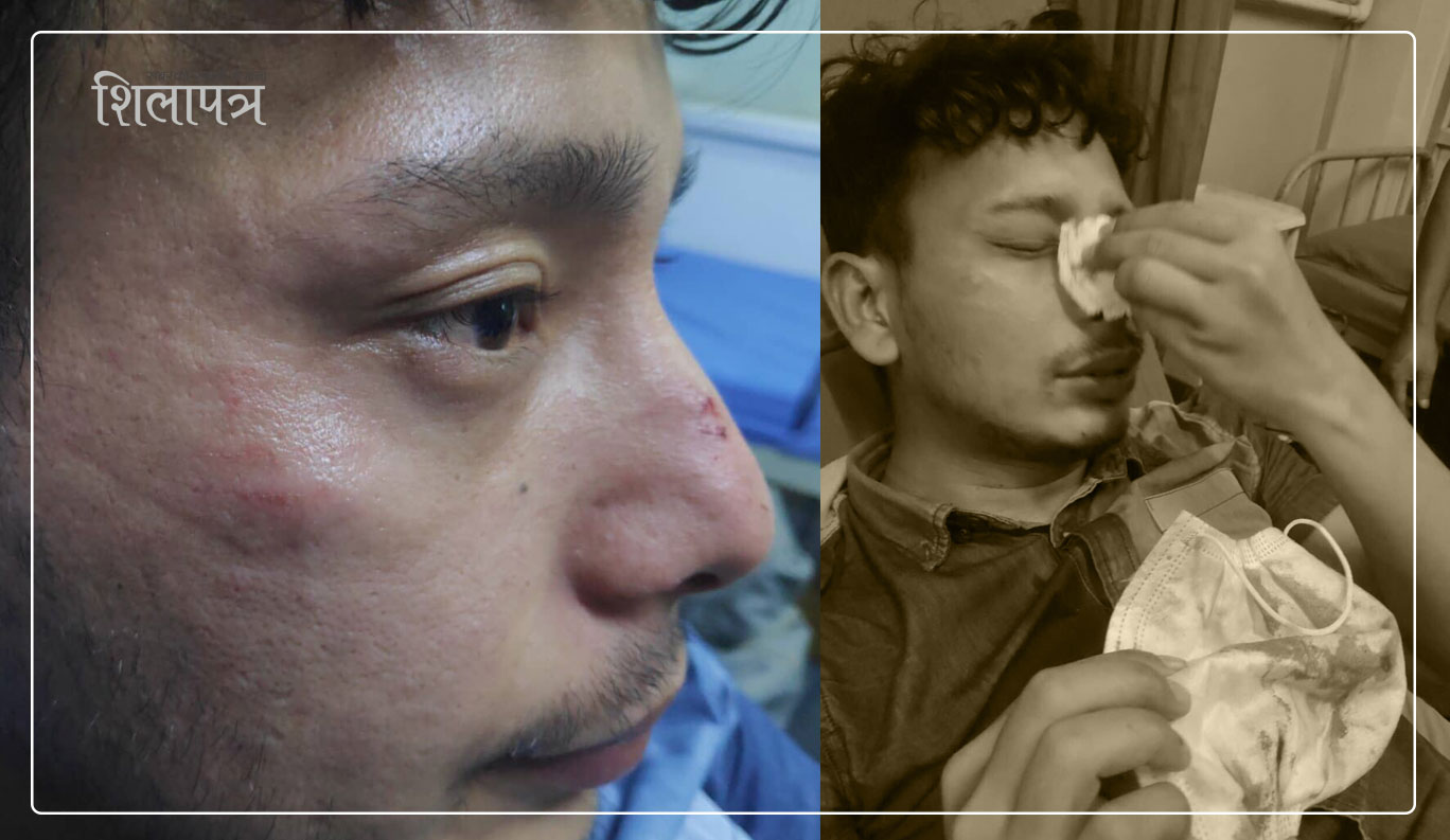 ललितपुरमा डाक्टर कुट्ने ट्राफिक प्रहरी जवान निलम्बन, असईसहित पाँच जना बग्गीखाना तानिए 