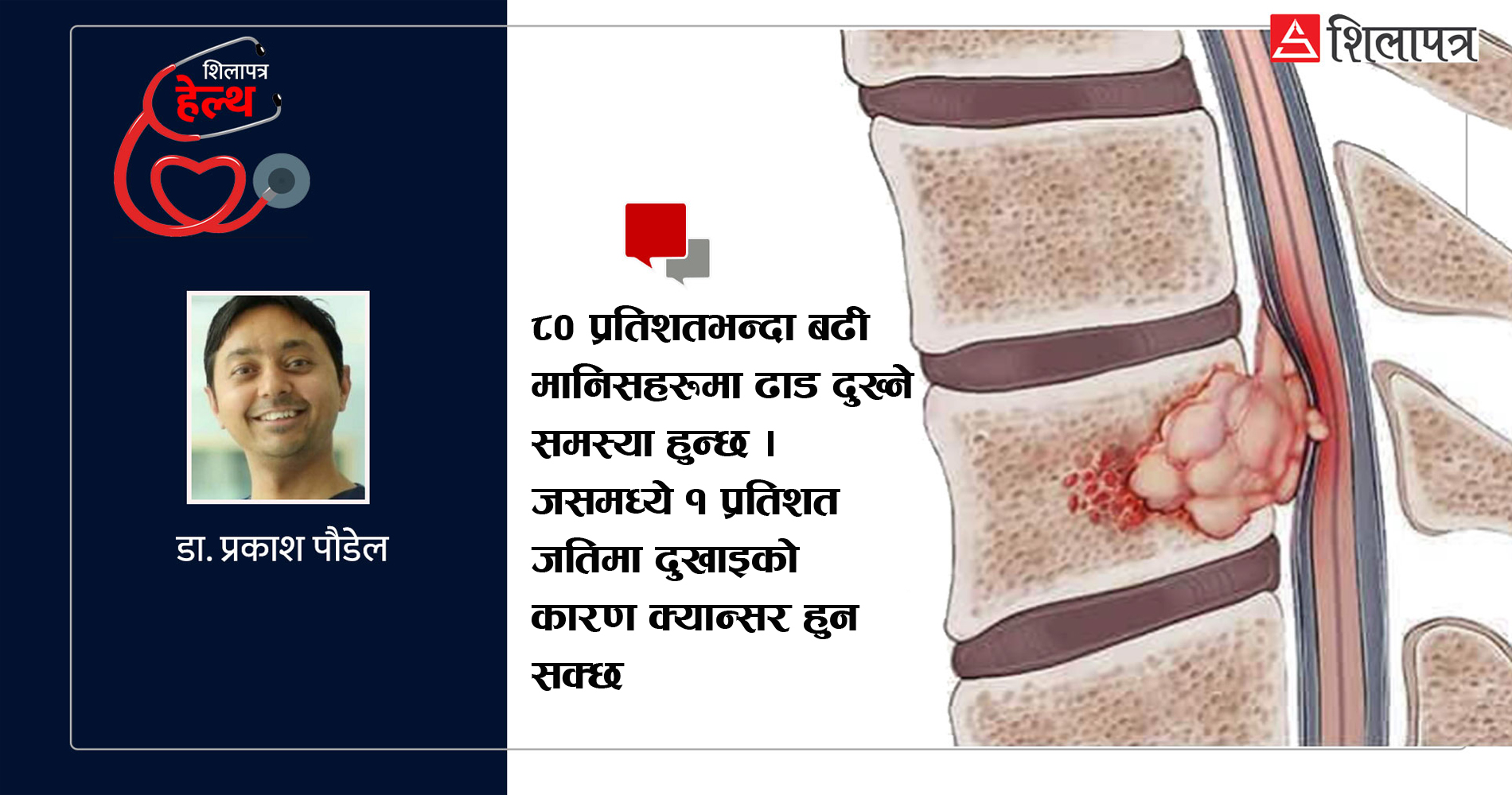 कस्तो दुखाइ भएमा क्यान्सरको शंका गर्ने ? यस्ता छन् स्पाइनल ट्युमरका लक्षण र उपचार 